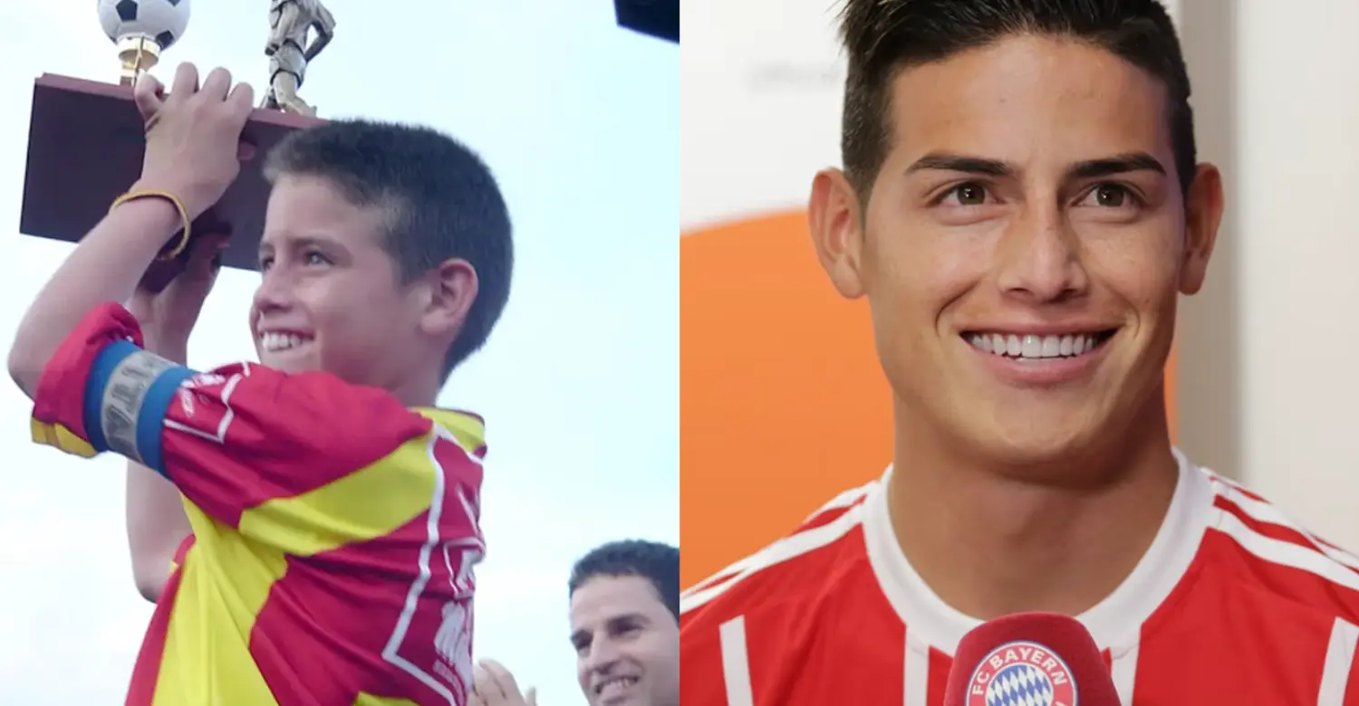 James Rodríguez teeth